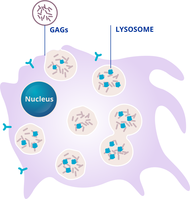 Mps Vii - Genetic And Rare Disease 